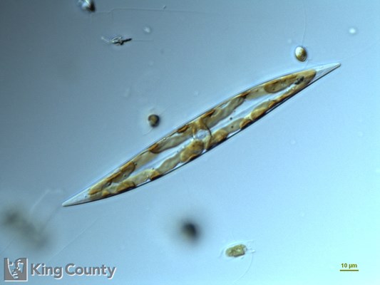 Photo of <em>Pleurosigma spp.</em>